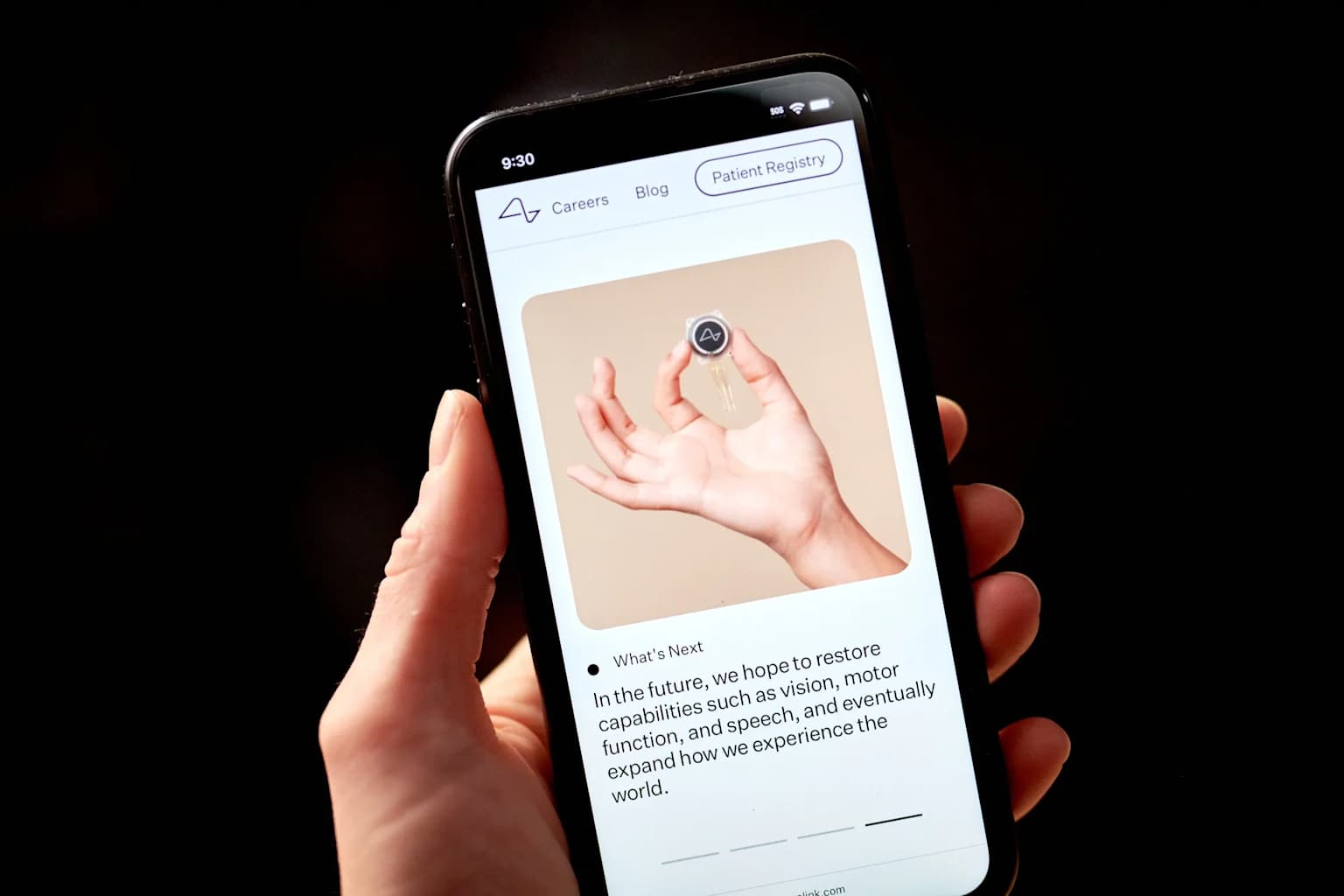 Demostración de Neuralink muestra implante cerebral restaurando el habla a un usuario con discapacidad