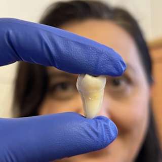 Human teeth grown in a lab could replace fillings