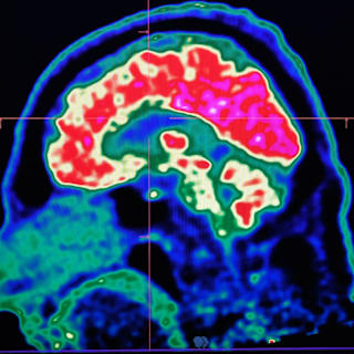 The Human Brain is Very Slow