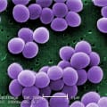 Staphylococcus aureus