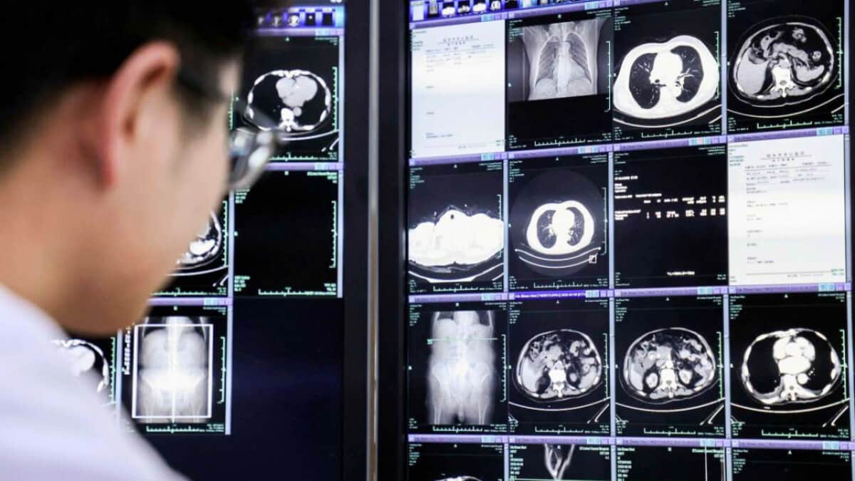 Grape AI from Alibaba outperforms radiologists in detecting stomach cancer