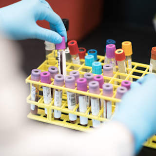 New Alzheimer's Blood Test Reduces Risk
