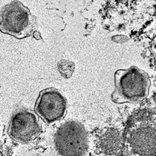 Study reveals 230 new marine viruses linked to algae control