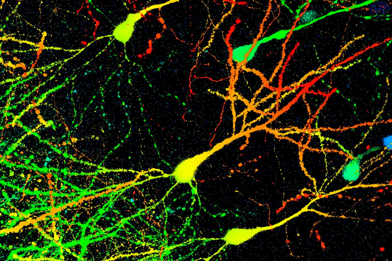 Un estudio descubre que los ratones retienen recuerdos tras perder la mitad de sus conexiones cerebrales