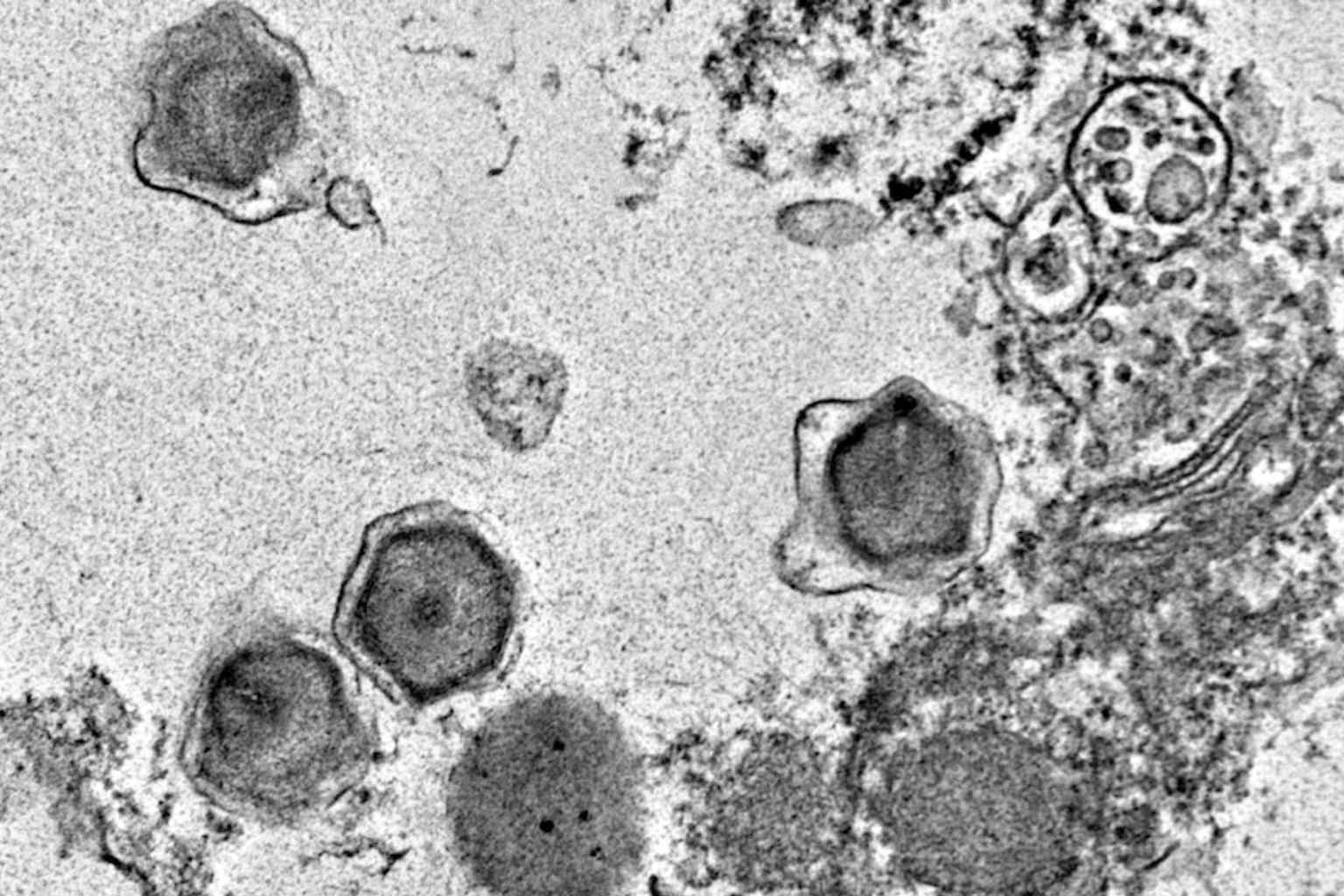 Scientists discover 230 new giant viruses hidden in the ...