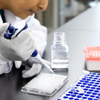 Scientists find 81 hidden genes driving deadly breast cancer
