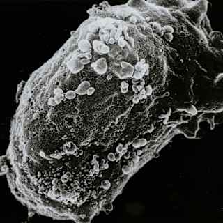 AI Tool Diagnoses Diabetes, HIV, and Covid-19