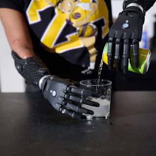 Open Bionics creates world’s most advanced bionic arm