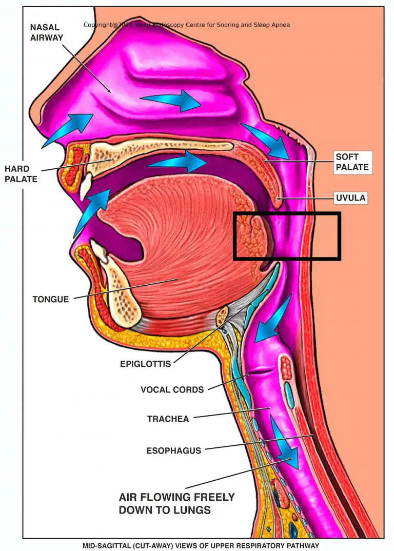Upper airway anatomy diagram showing nasal passage, soft palate, uvula, tongue, and throat — snoring anatomy