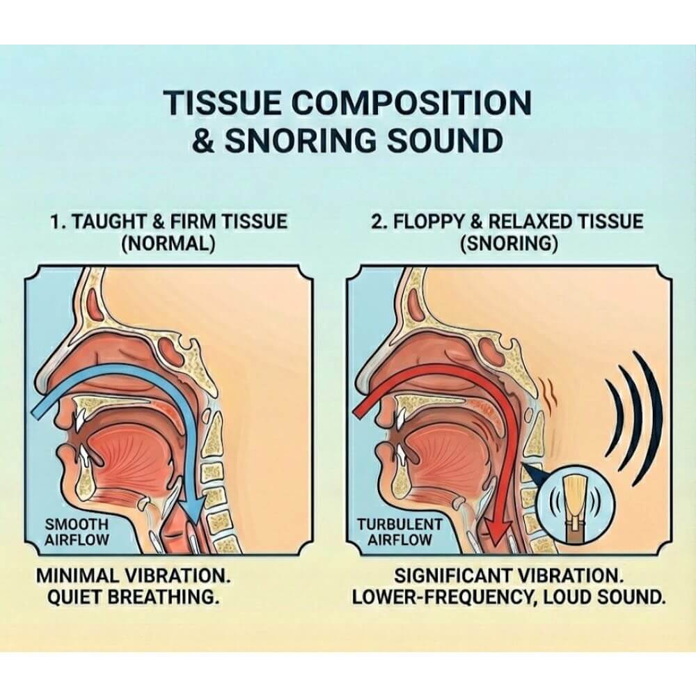 Diagram showing normal firm throat tissue vs floppy relaxed snoring tissue causing vibration