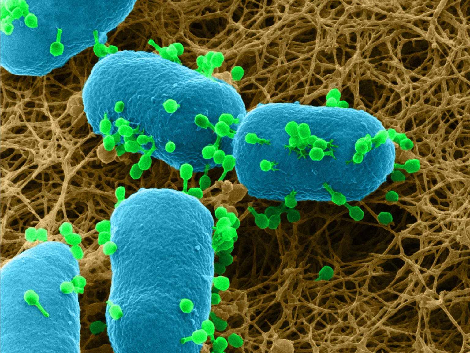 Laboratorio de microbiología y detección de patógenos