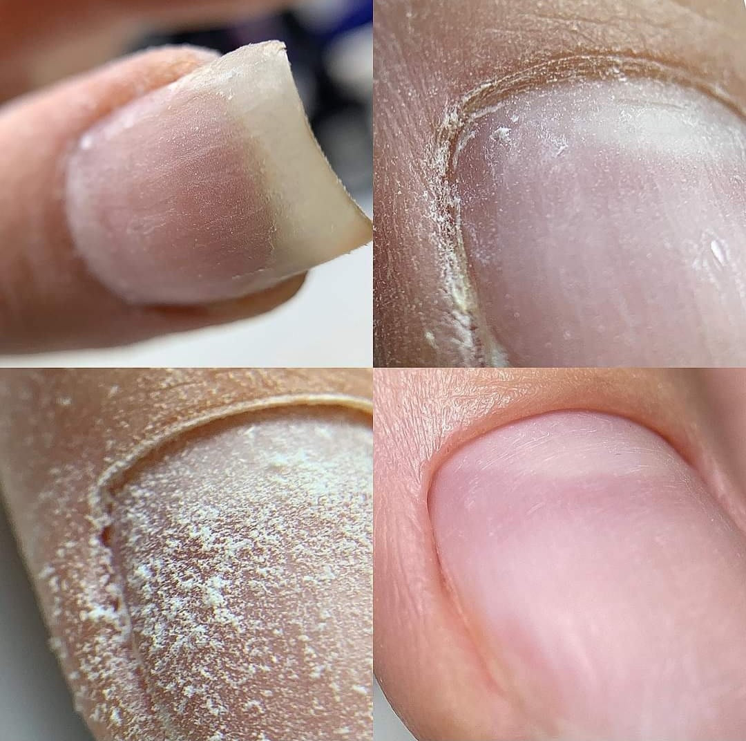 Russian manicure before after