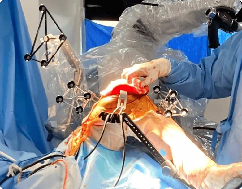 Orthopaedic Joint Replacement Surgery Kute Hospital