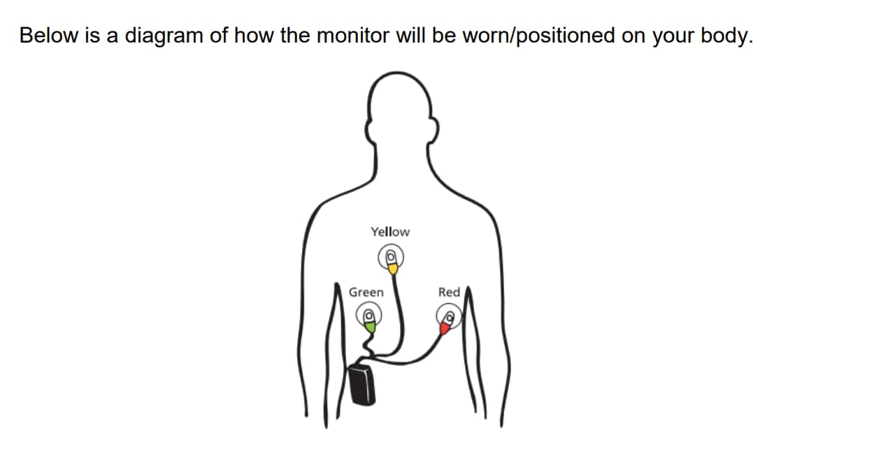 ECG diagram used in cardiology education