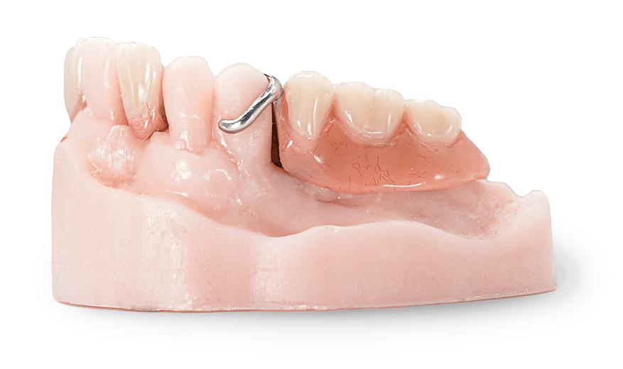 Chrome cobalt partial dentures