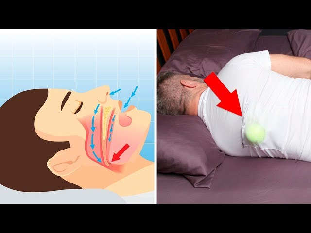 Sleep Apnea Without CPAP — 9 Treatments That Actually Work 10 Split image showing cartoon of person lying on back with airflow arrows and real photo of person sleeping on side with tennis ball attached to back of shirt
