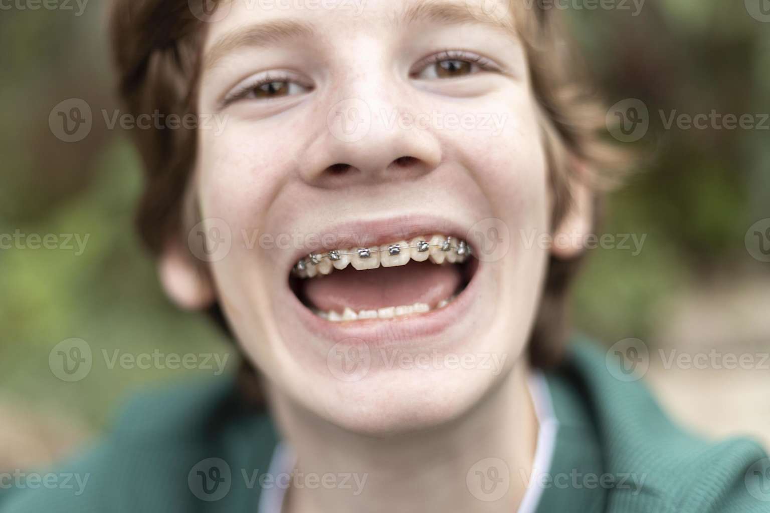 Confident adult smiling with braces in a professional workplace setting