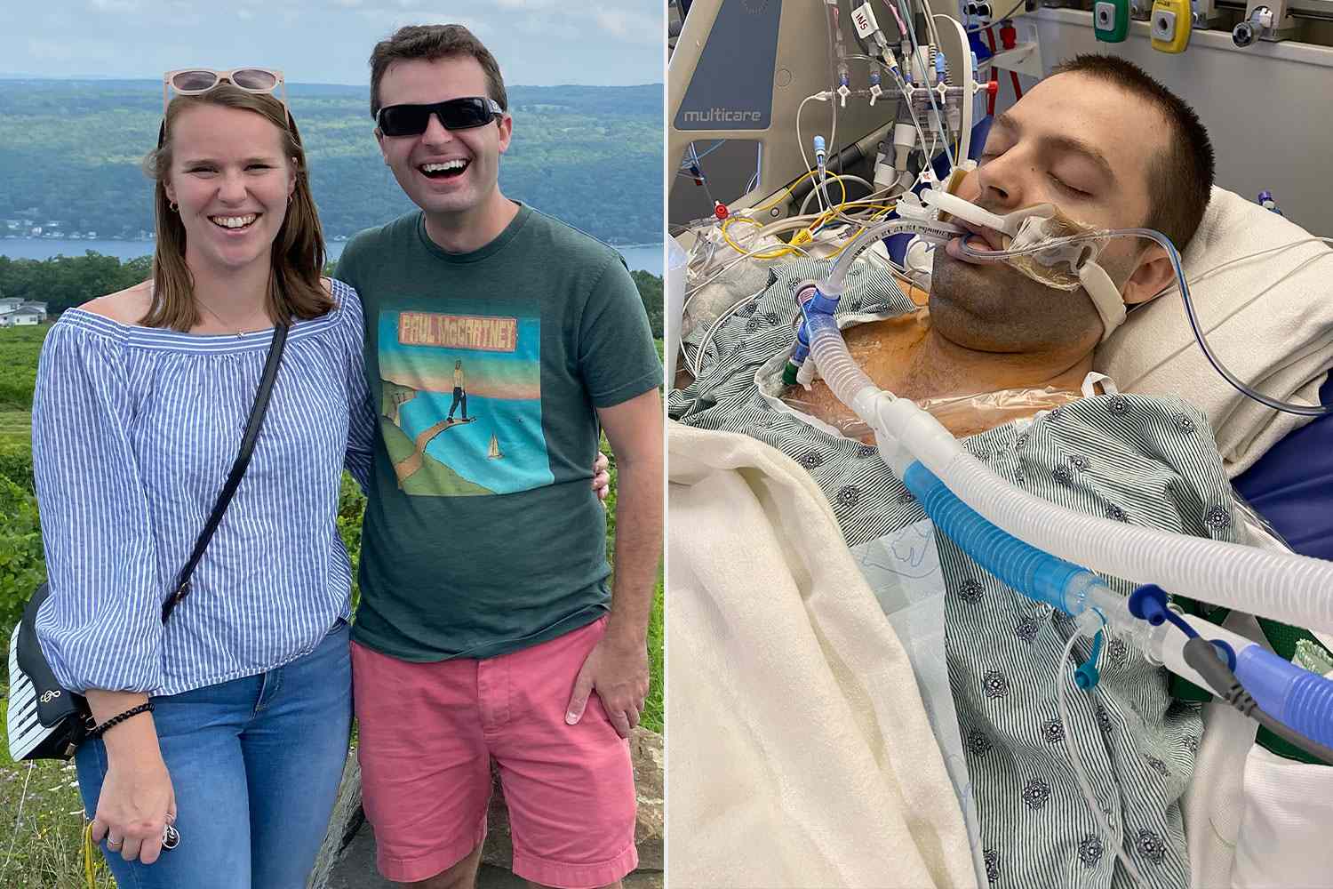 Dean Comstock - Before and During Cancer Treatment