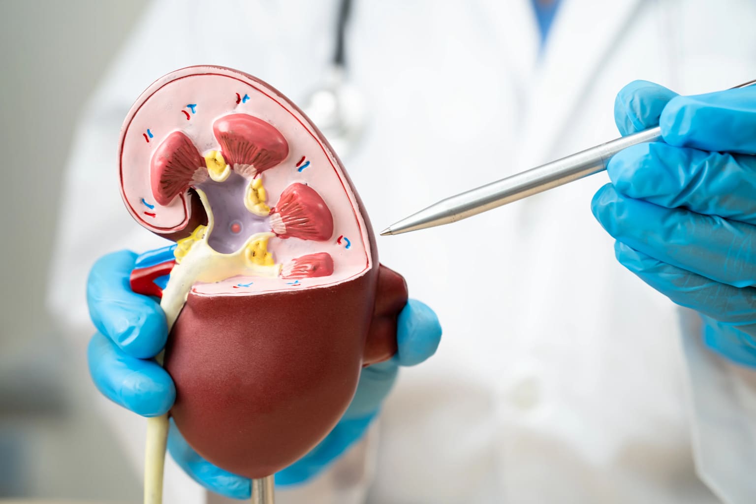 Urology PCNL Kidney Stone Surgery Kute Hospital