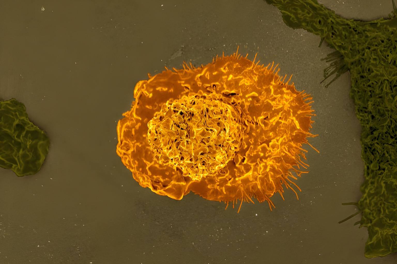 Macrophage