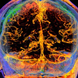 Slime Barrier Protects the Brain