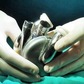 Man Survives with Titanium Heart