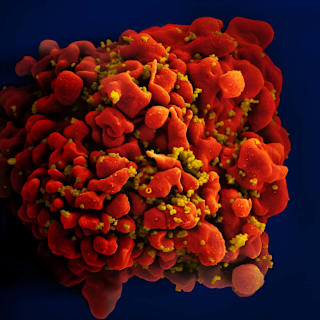 Single-Cell Clock Reveals Immune Aging