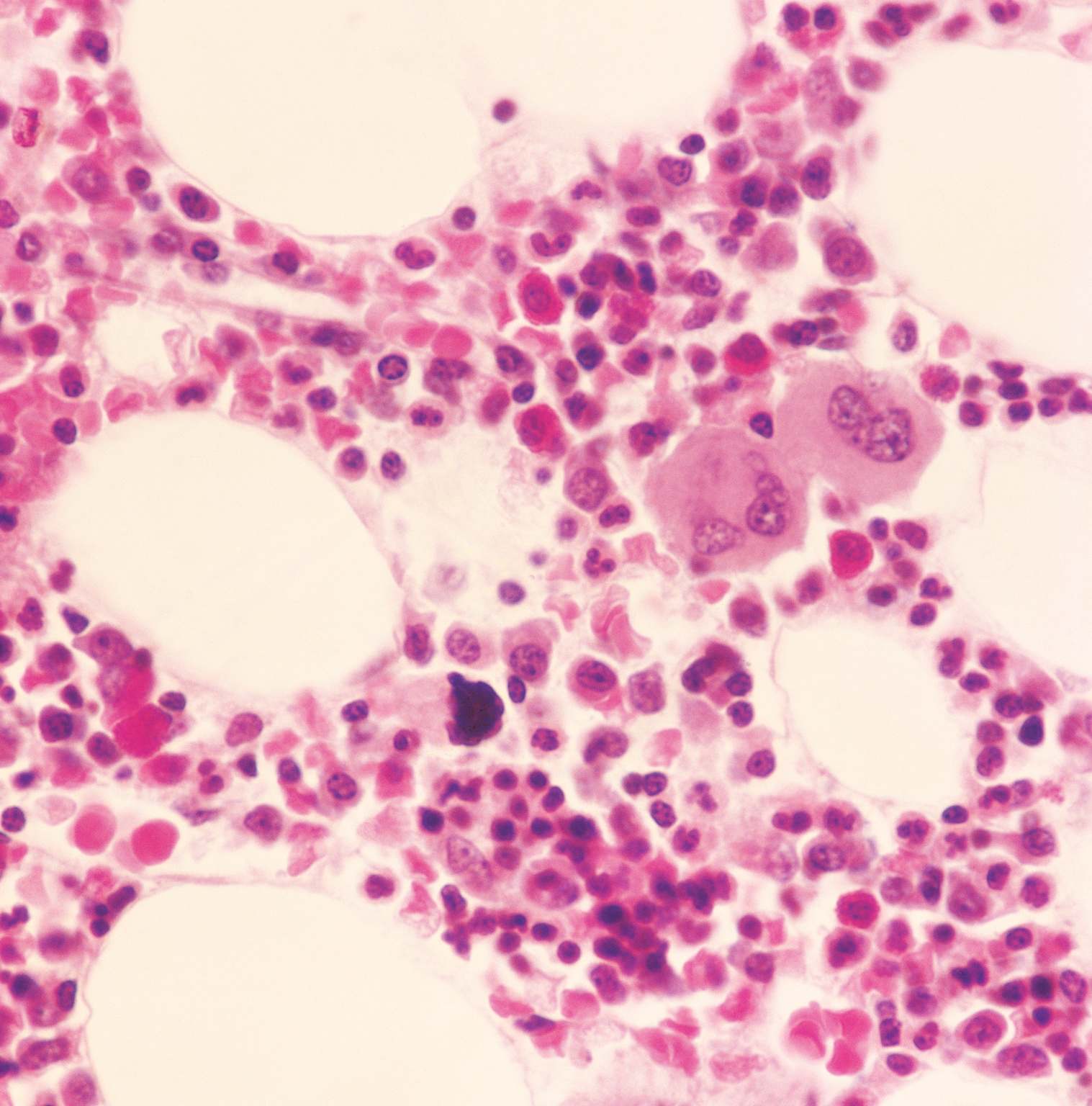 Myelocytes...