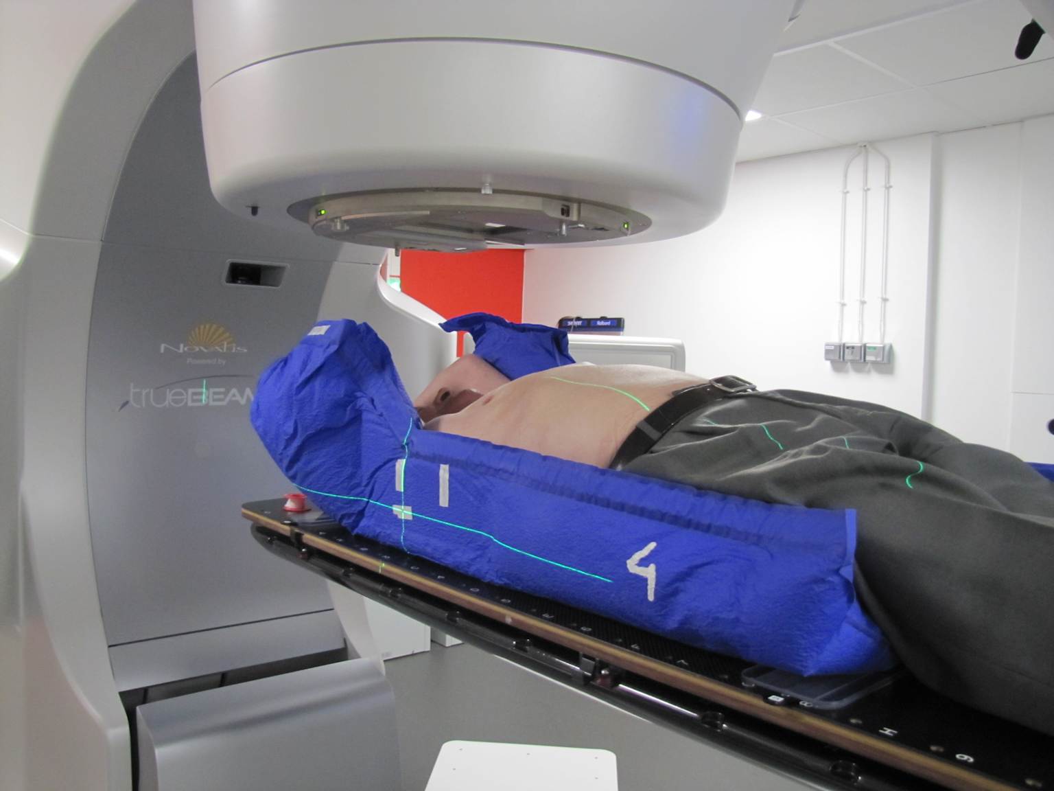 A patient positioned on a treatment table under a TrueBeam linear accelerator for a radiotherapy session, with green laser lines indicating precise alignment