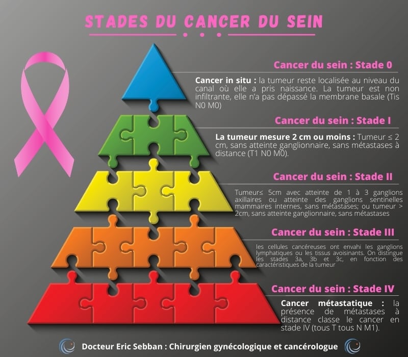 An illustration detailing the five stages of breast cancer, from in situ (Stade 0) to metastatic (Stade IV), with corresponding descriptions