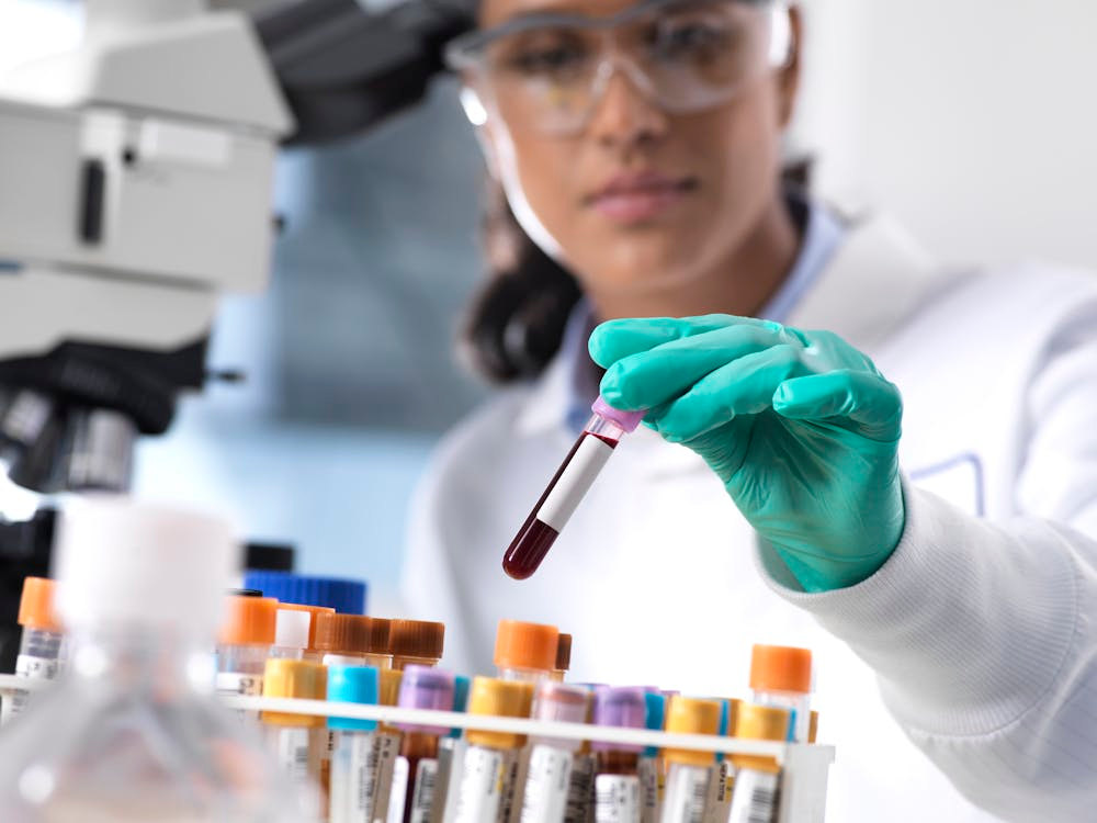 Лабораторные анализы