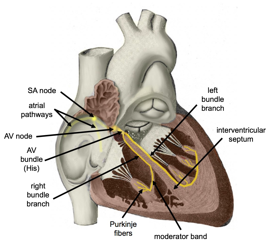 Diagram of the human heart's conduction system showing SA node, AV node, bundle branches, and Purkinje fibers