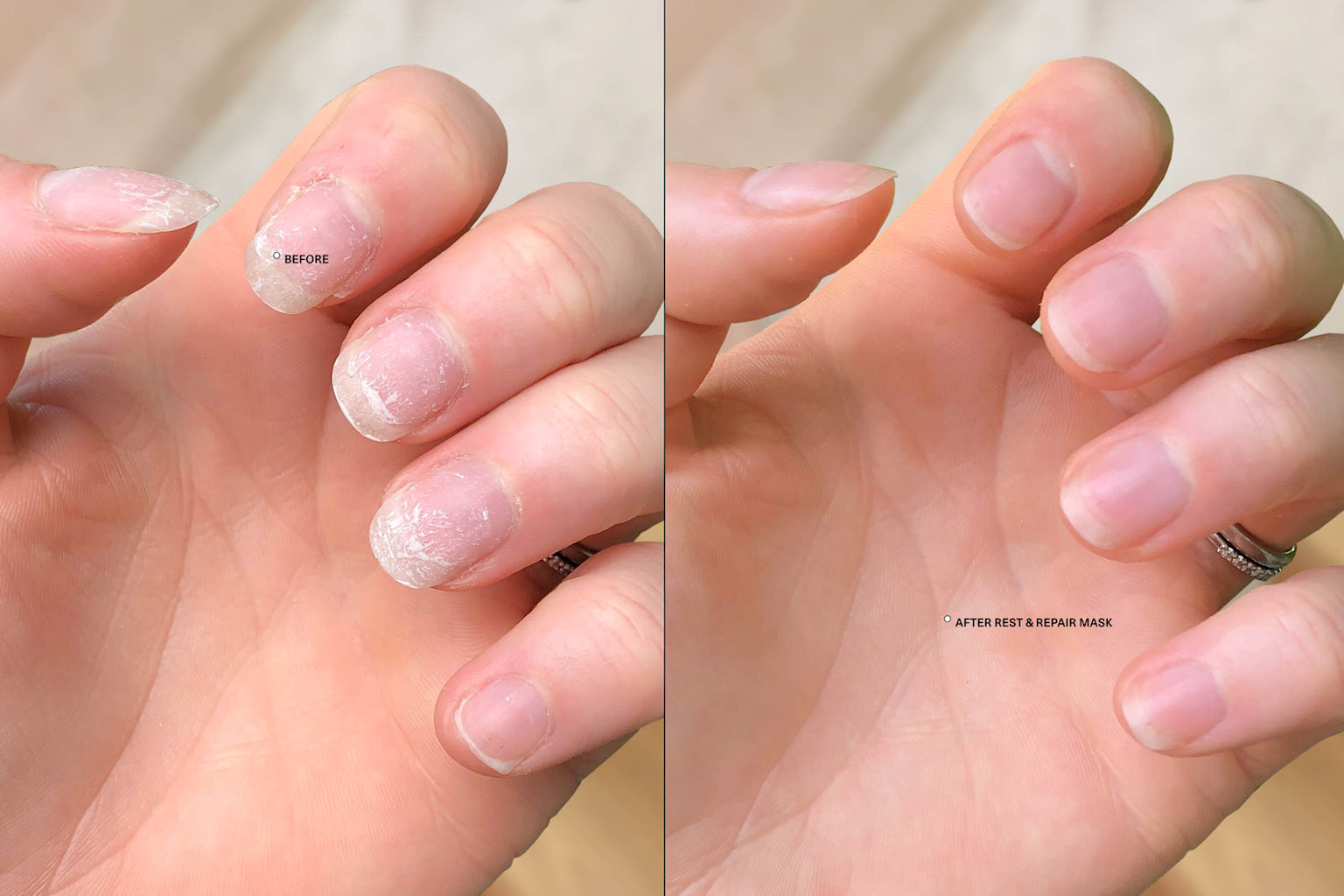 Before and after results of brittle, cracked nails treated with a rest and repair mask