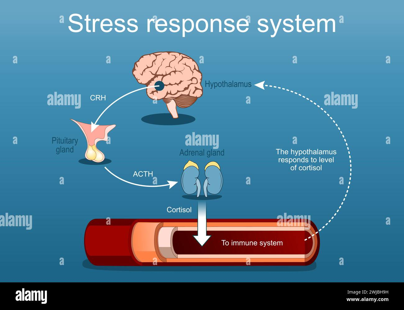 Diagram of the human stress response system showing how the hypothalamus, pituitary gland, and adrenal glands interact to regulate cortisol release and impact the immune system.