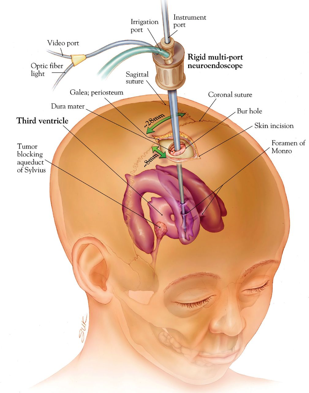 Understanding Brain Health