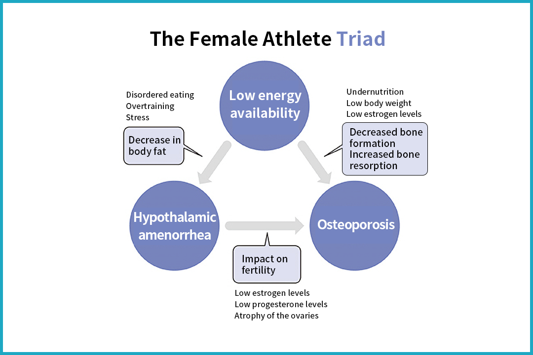 Diagram explaining the female athlete triad: low energy availability, hypothalamic amenorrhea, and osteoporosis interconnected with hormonal and nutritional factors