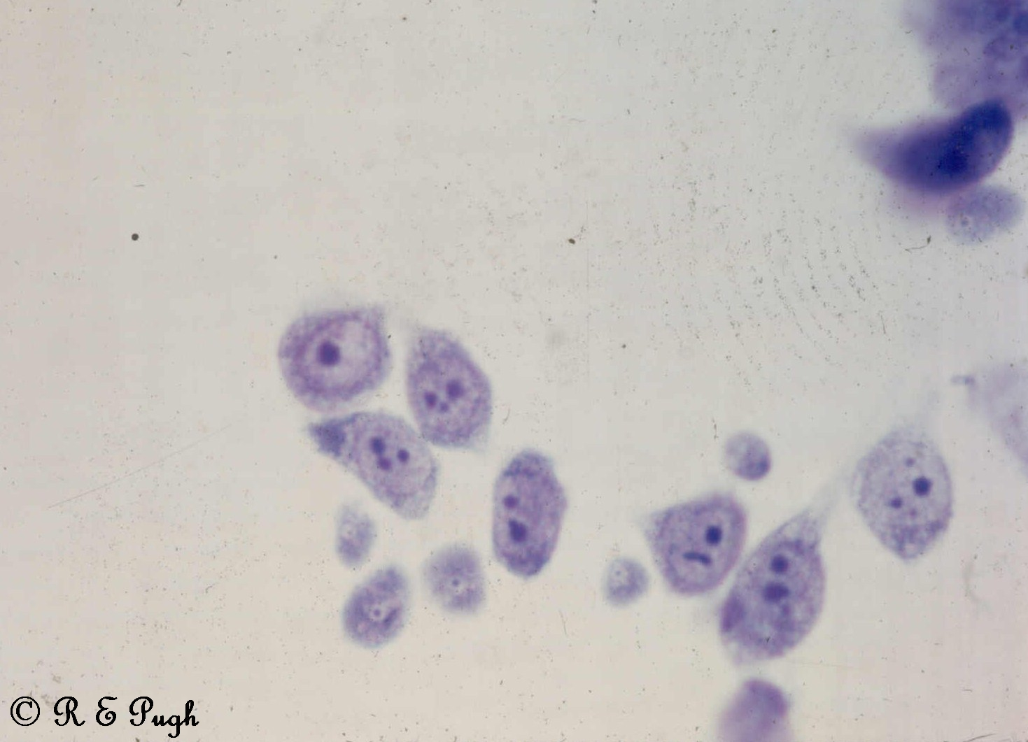 Microscopic image of Naegleria fowleri trophozoites showing their characteristic amoeboid shape and internal structures