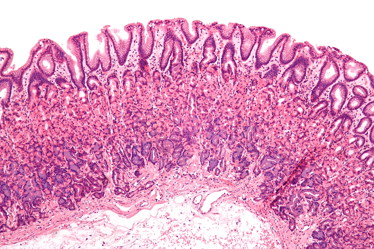 Histological view of normal gastric mucosa showing stomach lining layers and glands