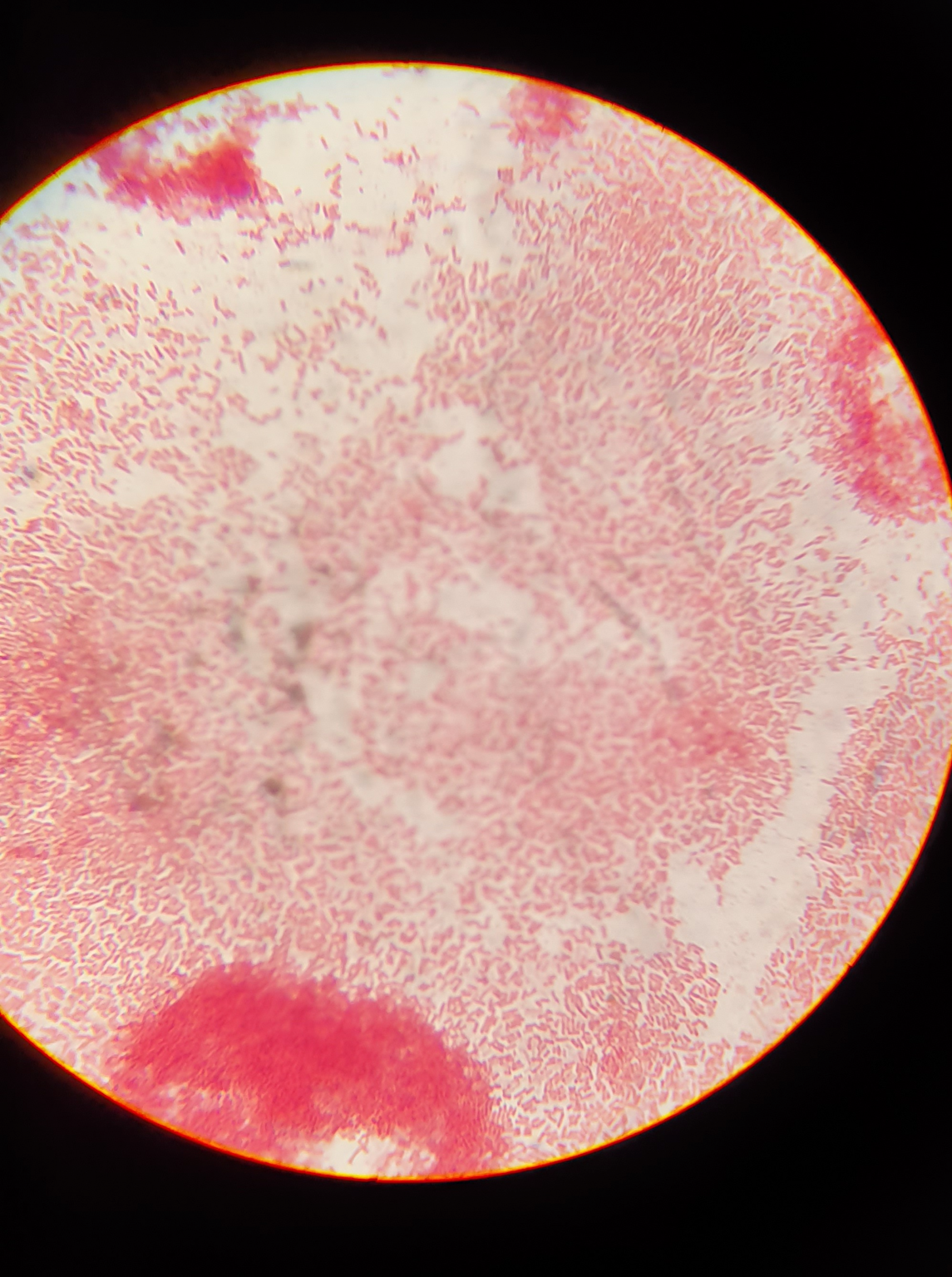 Microscopic view of Salmonella Typhi bacteria, the cause of typhoid fever, stained and magnified under a microscope