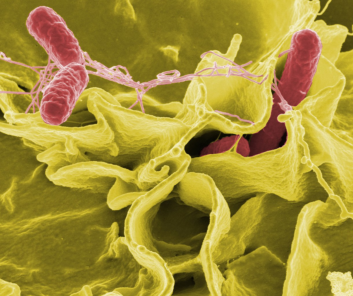 Microscopic view of Salmonella typhi bacteria interacting with human cells, the causative agent of typhoid fever