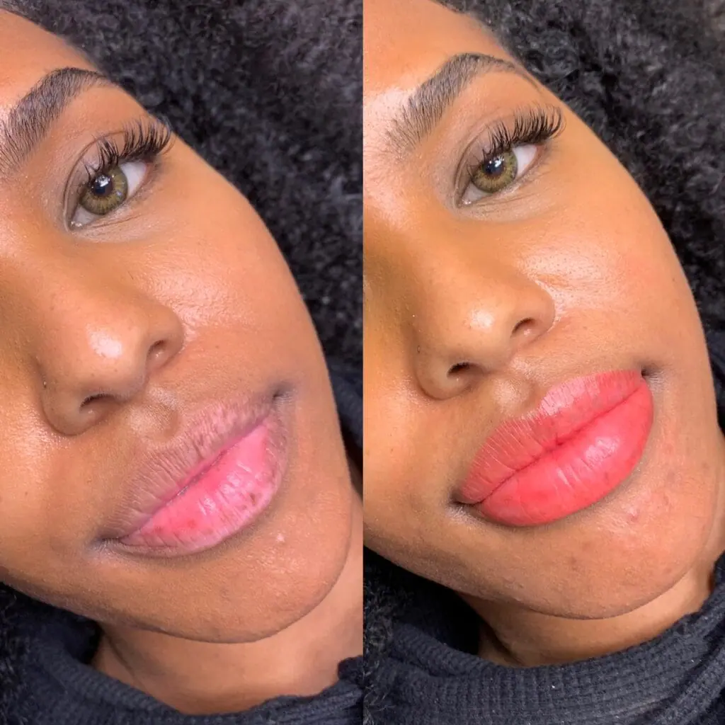 Lip blush tattoo before after showing dark lip neutralization