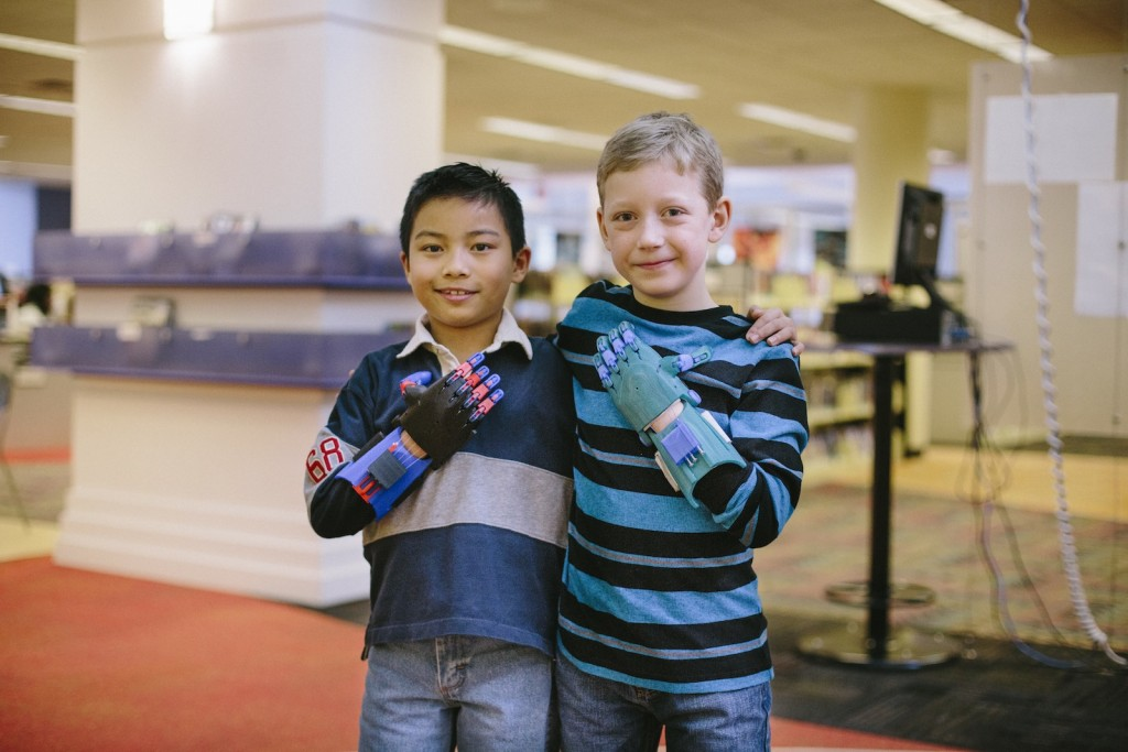 Children with 3D printed prosthetic hands