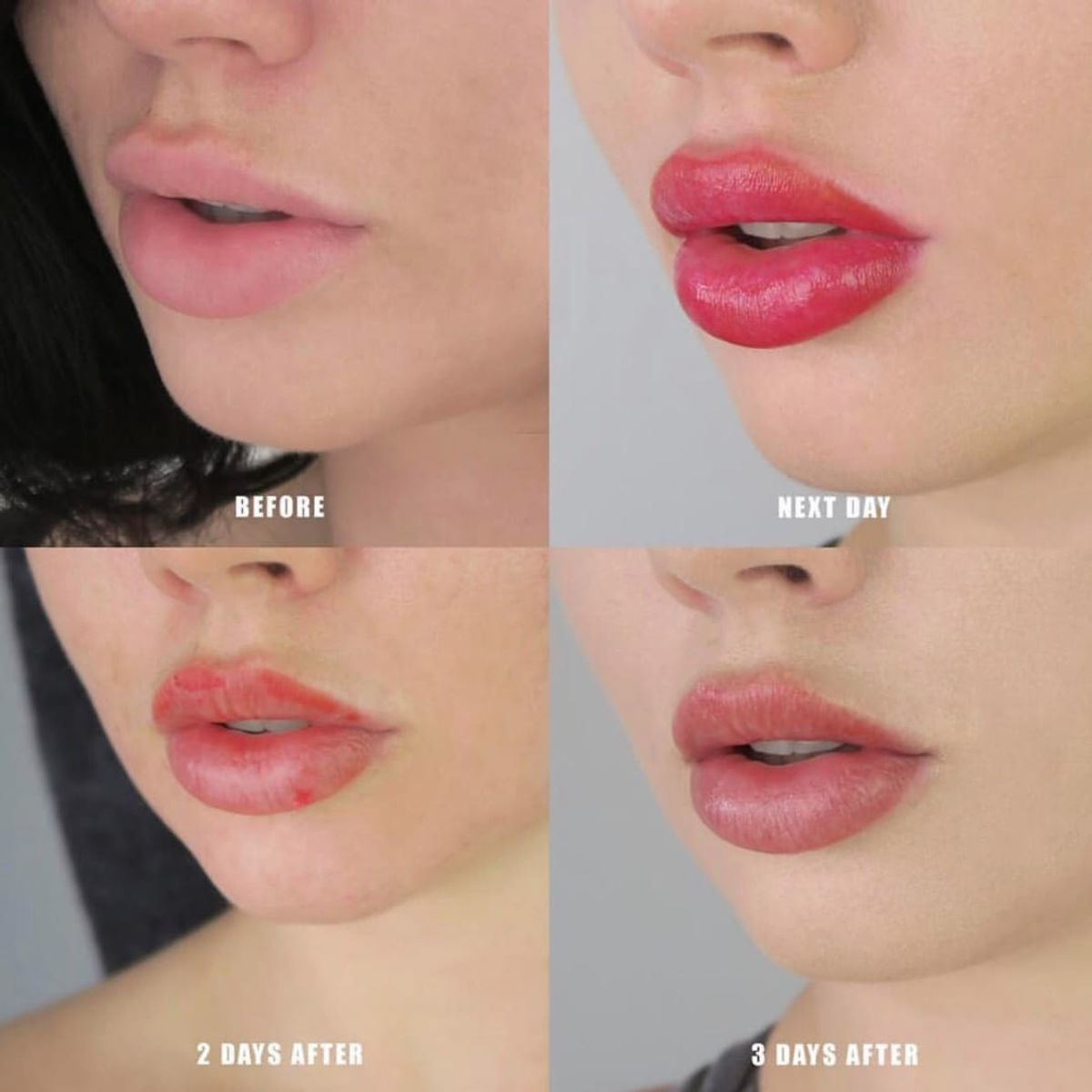 Lip tattoo healing process showing before, day 1, day 2, and day 3