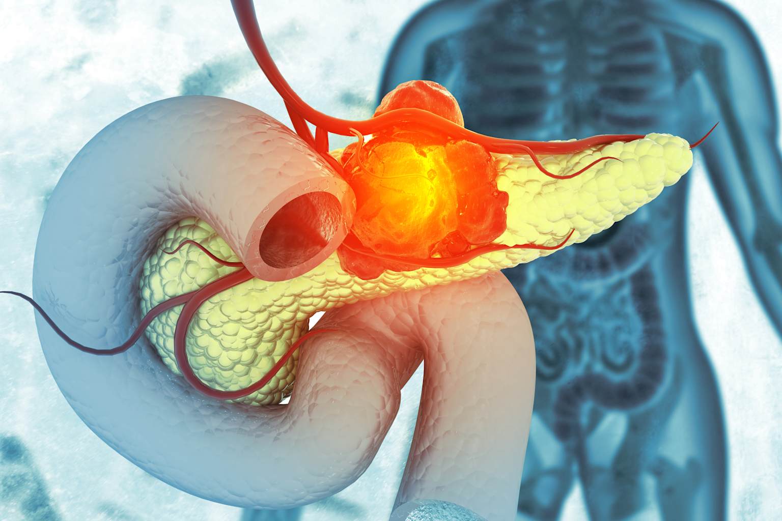 Estudio de Harvard encuentra forma de prolongar la respuesta a fármacos KRAS en el cáncer de páncreas